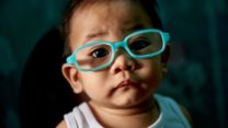 a premature baby who suffers from ROP