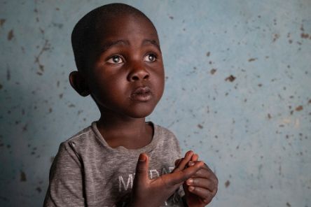 Ein etwa dreijähriger Junge mit auffallend weißen Pupillen.