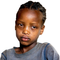 Porträt eines etwa fünfjährigen Mädchens mit geröteten Augen, das nicht lächelt.