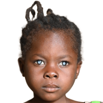 Ein kleines Mädchen mit geflochtenen Zöpfchen, die hochstehen, und ganz weißen Pupillen.